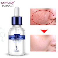 OMY LADY HANCHAN Skin Care essence Deep Facial Anti Aging Hyaluronic Acid serum15ml Intensive Face Lifting Firming Anti Wrinkle
