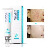 BAIMISS Acne Cleaning Cream Skin Care Remove Repair Comedone Pimple Acne Quickly Face Acne Cream Remover Anti Acne Treatment